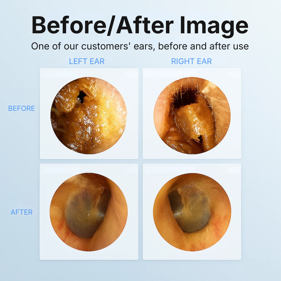 Lumivela ClearEar™ Pro